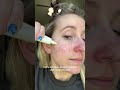 My fav new skincare product Dr.Reju-All US
