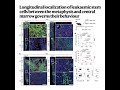 987-The Metaphyseal Niche Governs Leukaemic Stem Cell Fate