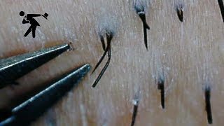 よく見える癒しの毛抜き⑬　【microscope】【tweezers】【แหนบ】