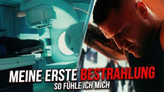 Meine erste Hirnbestrahlung...