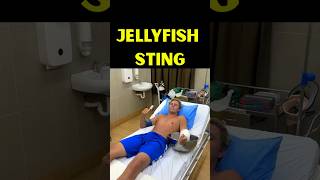 Near FATAL Jellyfish Sting in Fiji. #shorts