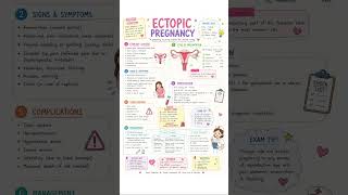 Ectopic Pregnancy Nursing Notes | Quick Study 📖