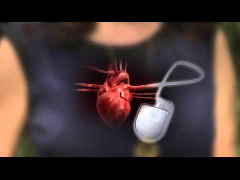 Video: Forskellen Mellem Pacemaker Og Defibrillator