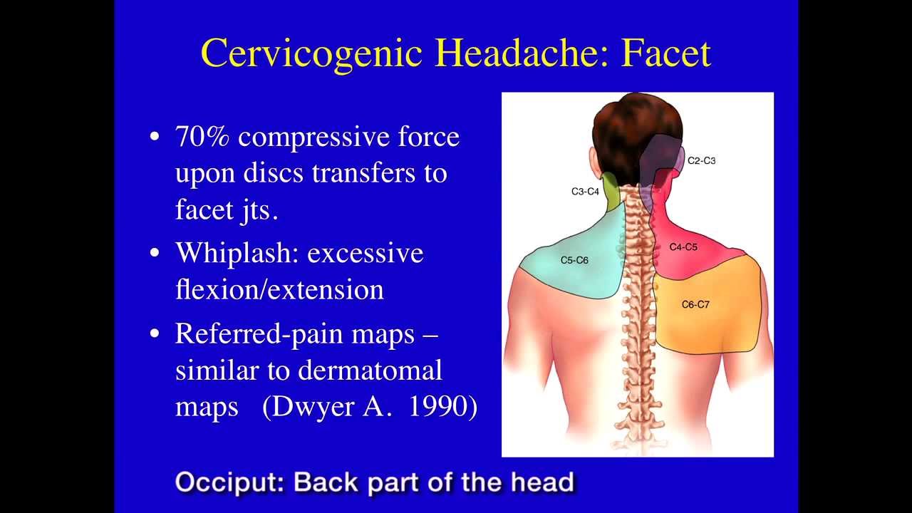 Headache Pain Ucsf Radiology