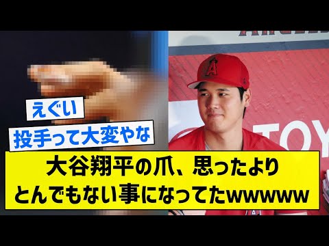 【閲覧注意】大谷翔平の爪、思ったよりとんでもない事になってたｗｗｗｗｗ【5chまとめ】