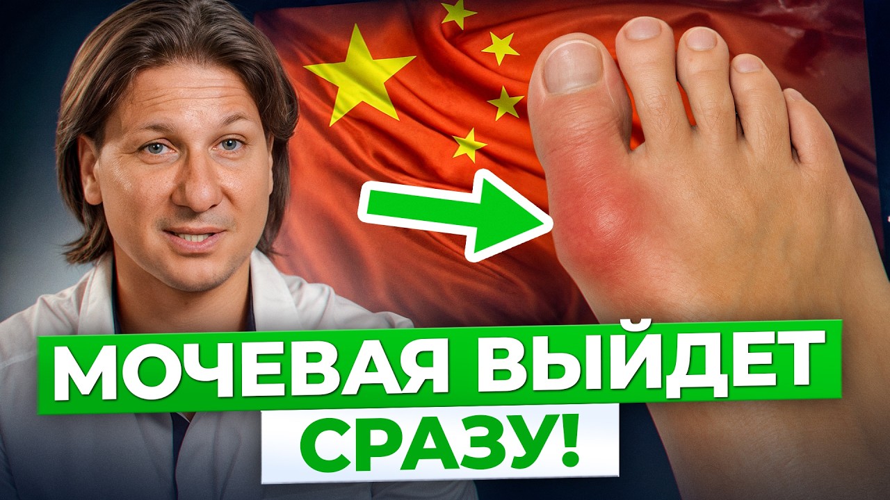 Как избавиться от боли при подагре? Вы удивитесь, но подагра боится обычной…