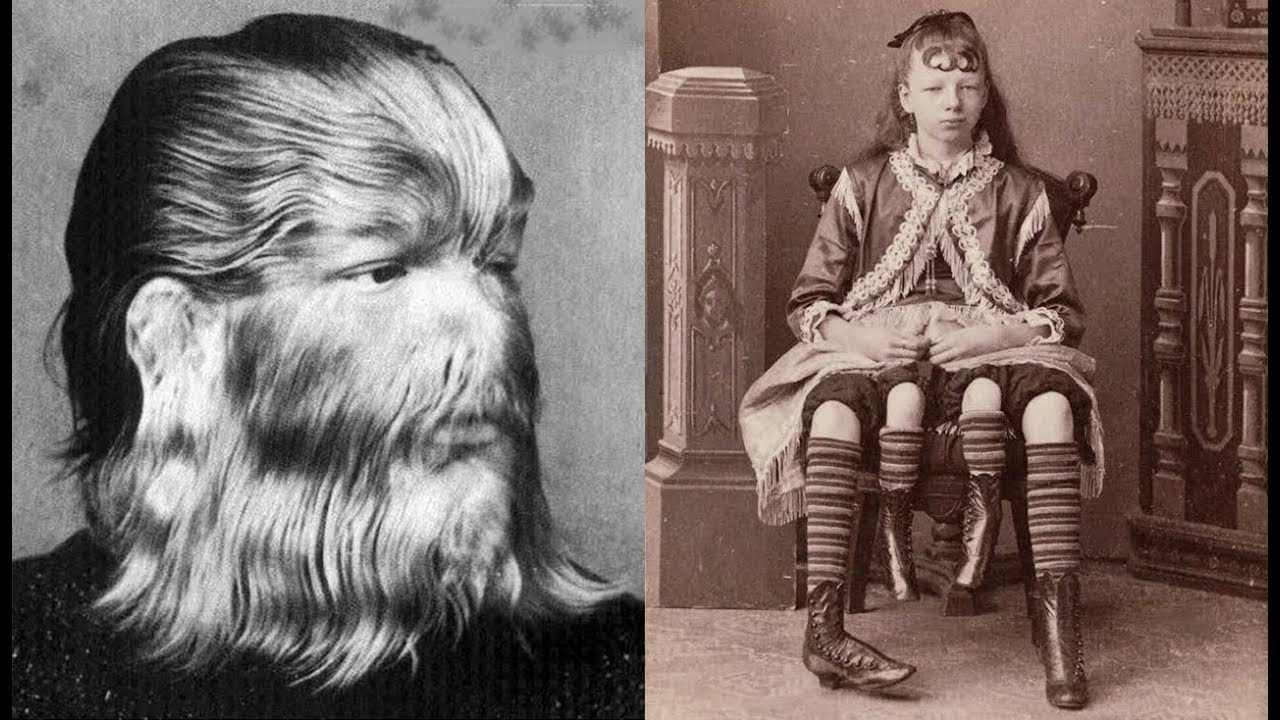 7 Personas con apariencias extrañas | FENÓMENOS DE CIRCO | FREAKSHOW ...