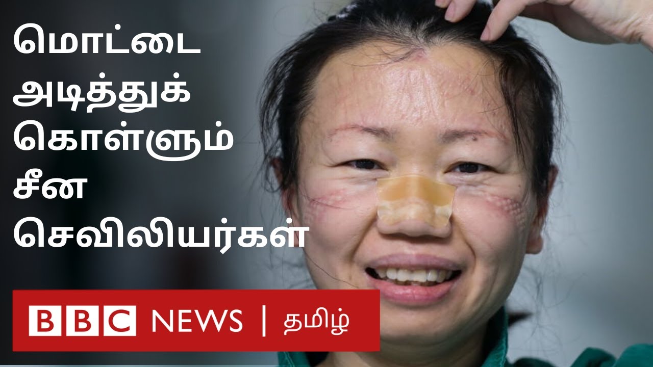 கொரோனாவால்  மருத்துவர் மரணம்  | Corona virus | china doctors | covid-19 |