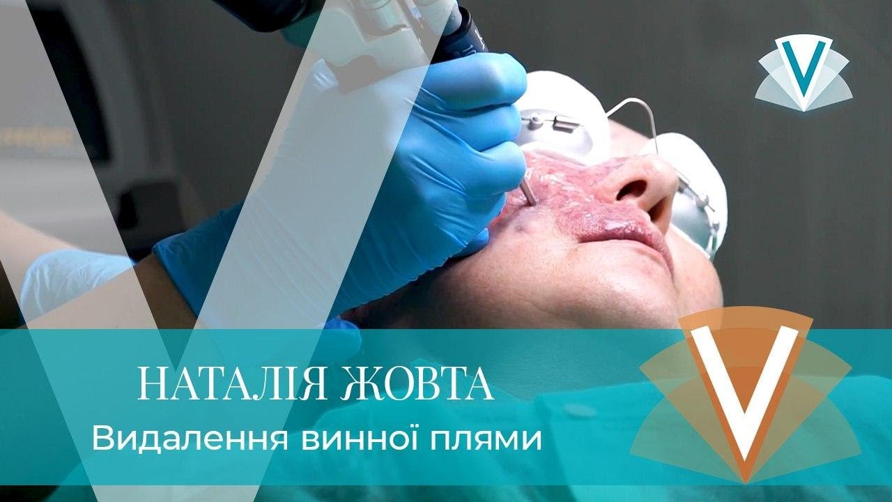 Удаление пятен в машине