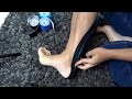 Achilles Tendonitis Kinesio Taping | Northern Soul channel