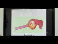 Chronic otitis media  safe type part 1 english patient teaching programme