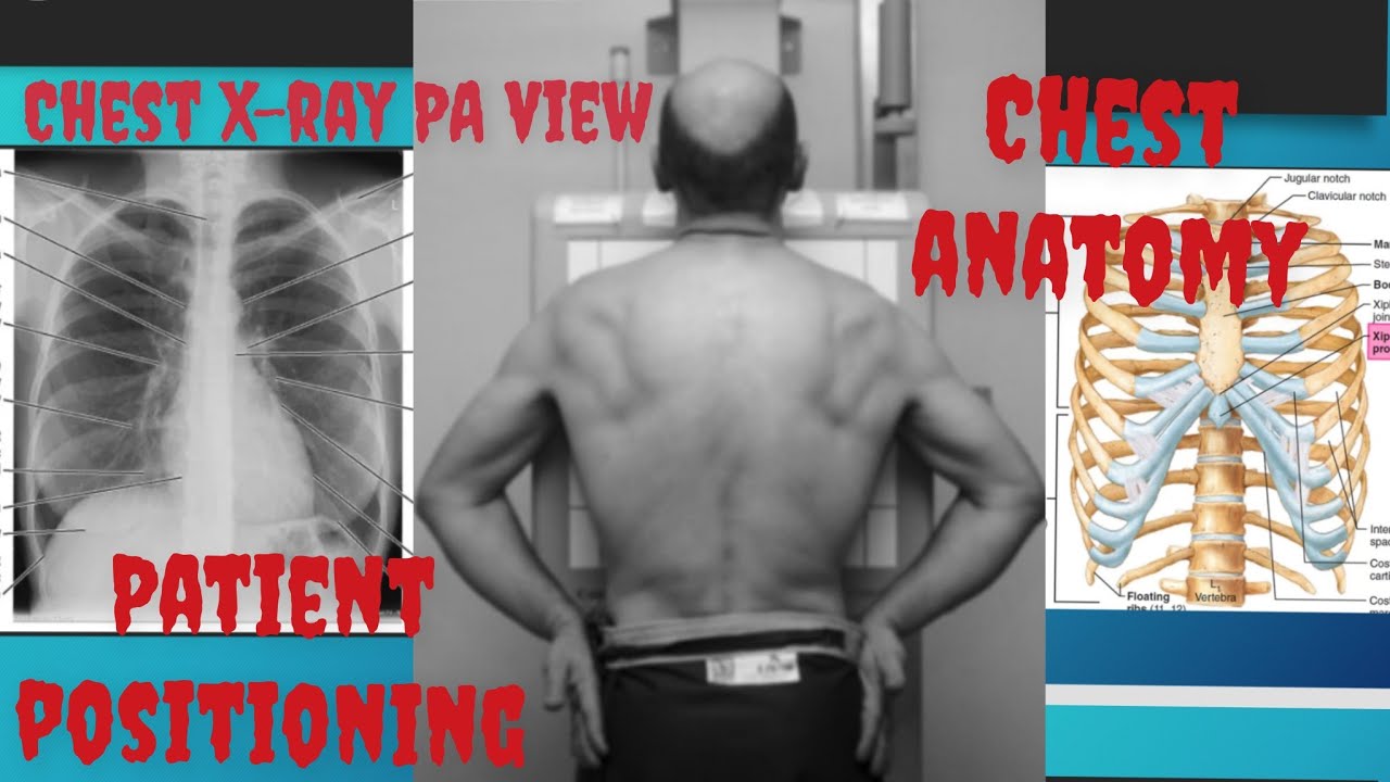 How to do chest Xray PA view Total procedure for chest Xray How