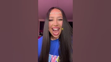 Used to get bullied all the time for my gummy smile, but confidence always wins #shorts