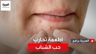 صحتك+ | أطعمة فعالة لمحاربة حب الشباب