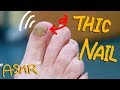 THICK &amp; GUNKY Toenail removal; Blessing Her Toenail