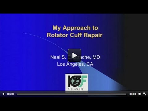 orthopedic banawe My Approach to Rotator Cuff Repair