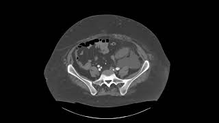 Abdominal Case Conference 2025 - Session 27