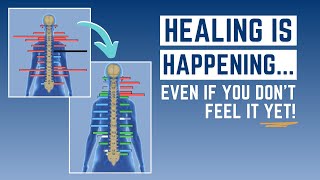 Q&A: What Does It Mean When Scans Are Changing But Symptoms Aren't Yet?