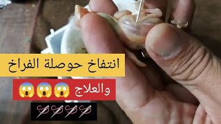 علاج انتفاخ حوصلة الفراخ بالهواء بطريقة 🧫🧫🧫 سهلة وبسيطة 🐣🐣🐣 باستعمال إبرة معقمة |ADENOVIRUS|