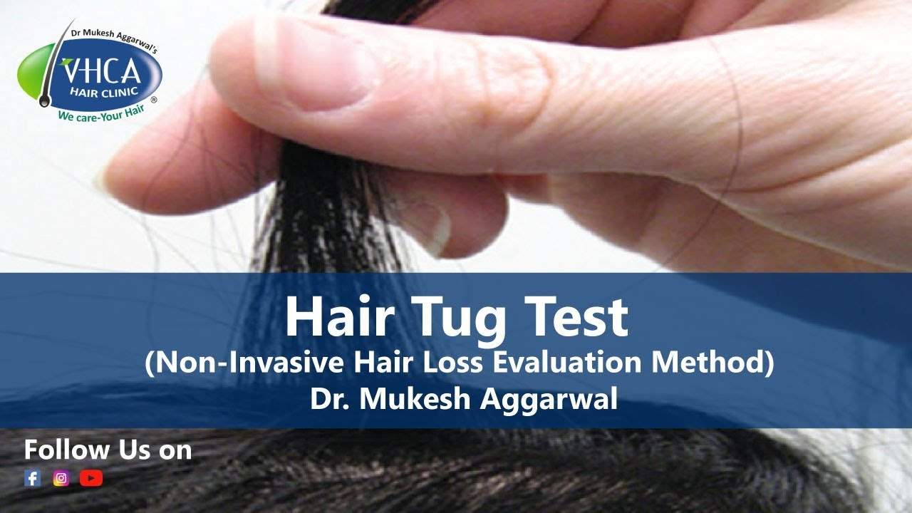 Hair Tug Test Non Invasive Hair Loss Evaluation Method Dr Mukesh