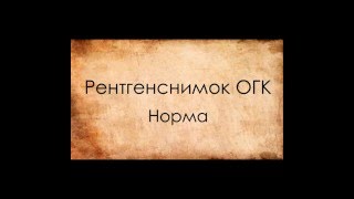 видео Бронхит на рентгеновском снимке