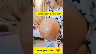 Pregnancy Challange Triple Baby