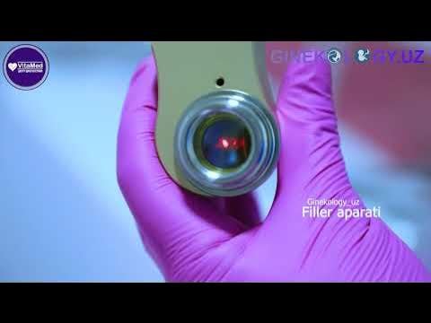 Gorilla bilan jinsiy aloqada bolgan qizlar