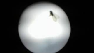 How Mosquitoes Use Six Needles to Suck Your Blood..Watch Now