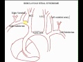 Subclavian Steal Syndrome