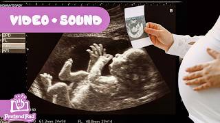 Ultrasound Scan Animation & Baby Sounds (VFX/SFX) – PretendPad Doctor Play