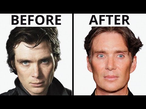 Cillian Murphy: All Natural? | Plastic Surgery Analysis