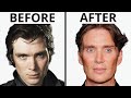 Cillian murphy all natural  plastic surgery analysis