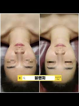 🌸👉데콜테 관리👉등관리🌸