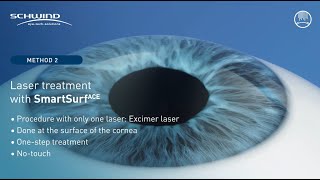 Touchless eye laser treatment: SmartSurface / TransPRK with SCHWIND AMARIS laser systems