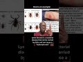 Too Many Doctors Are Misdiagnosing Diseases like Lyme Disease on Darker Skin Tones