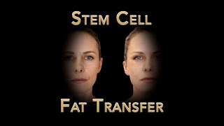 New Advancements In Plastic Surgery and Facial Rejuvenation - Cultured Stem Cell Fat Transfer