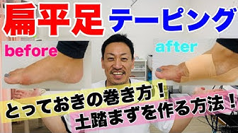 扁平足 Youtube