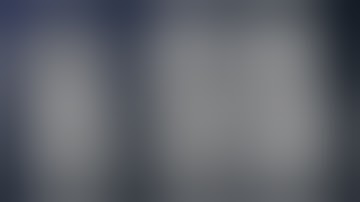 Fourth-Generation M2-RAG-S2 Bypass, Clip Occlusion and Flow Reversal of Giant Basilar Trunk Aneurysm