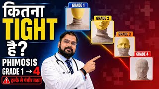 Phimosis Grades 1 to 5 | Tight Foreskin Symptoms & Treatment | Dr. Vijayant Gupta Phimosis Grades 1 to 5 | Tight Foreskin Symptoms & Treatment | Dr. Vijayant Gupta