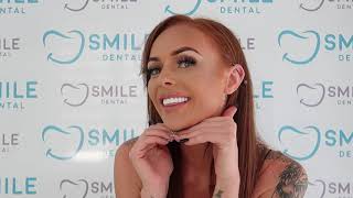 Smile Dental Turkey Reviews [Emilie From UK] (2020)