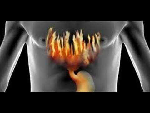 تحذير مضادات الحموضة خطر على الكلى و5 بدائل طبيعية تساعدك في العلاج
