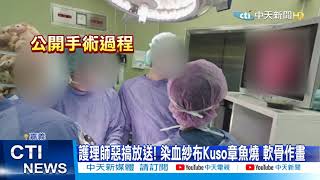 【每日必看】再爆開刀房醜聞! 護理師秀「軟骨作畫照」PO網 @中天新聞 20210316