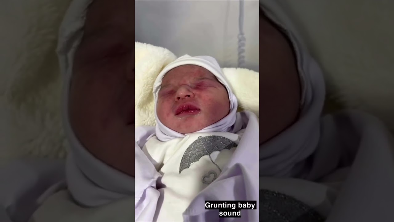 Newborn Baby with Grunting | Breathing Difficulty in NICU