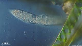 Unknown ciliate
