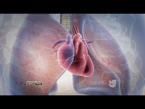 La hipertensión pulmonar una peligrosa enfermedad si nos es tratada a tiempo