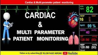 Cardiac & Multi parameter patient monitoring in ICU | Nursing Considerations