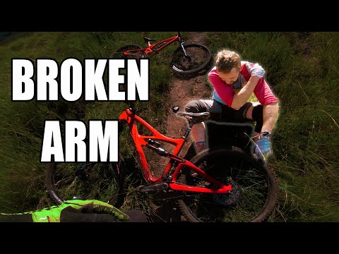 He Broke His Arm On South Africa's Wildest MTB Trail | Medical Cover IS IMPORTANT!!!