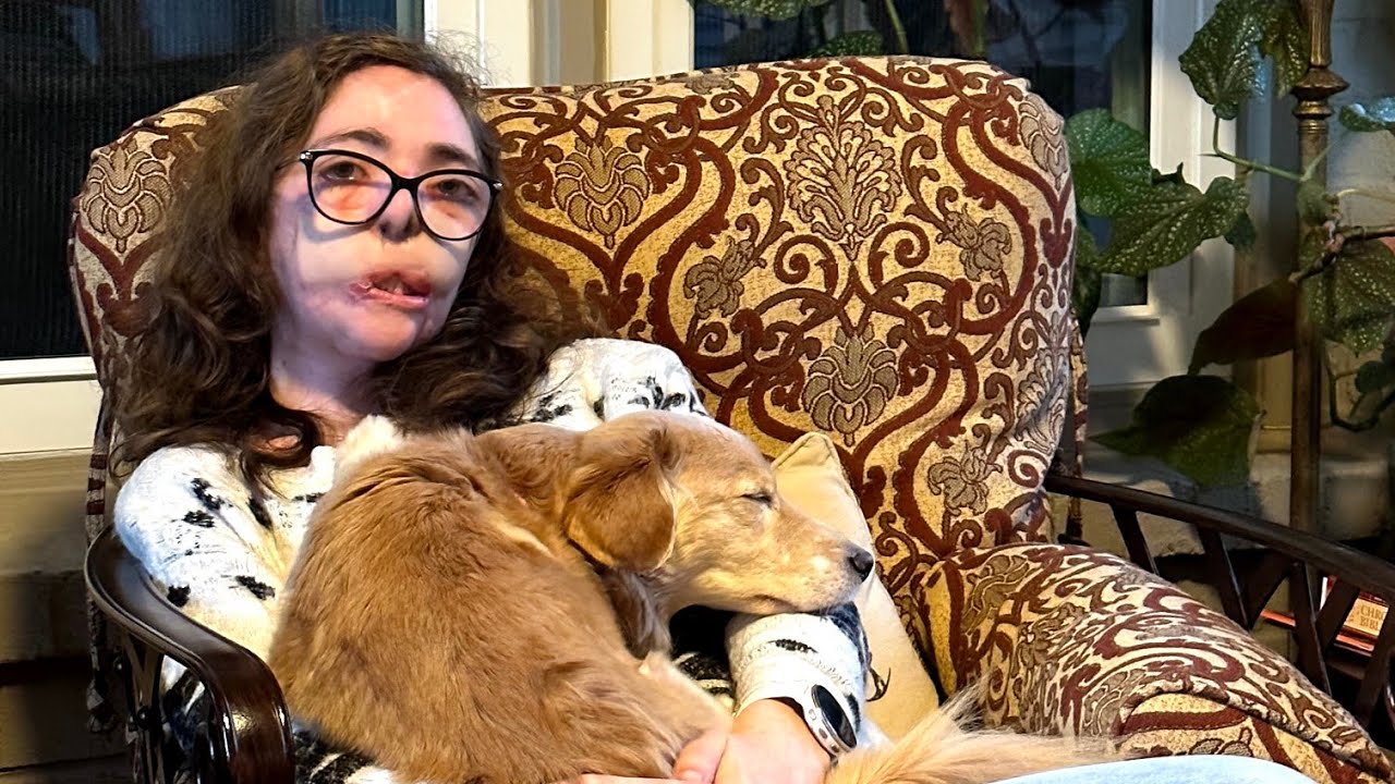2 Year Anniversary of the Dog Attack - YouTube