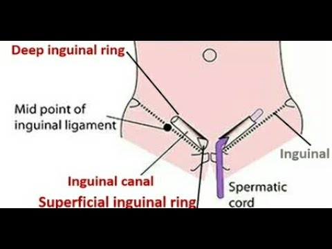 Inguinal Canal – Surgical Notes