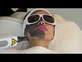 Carbon Peeling - Bellezza Kosmetikstudio